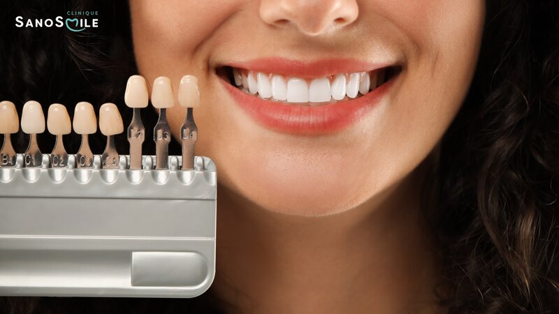 Sano Smile - Clinica stomatologie Bacau